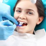 Smile Bright Understanding Teeth Whitening Options